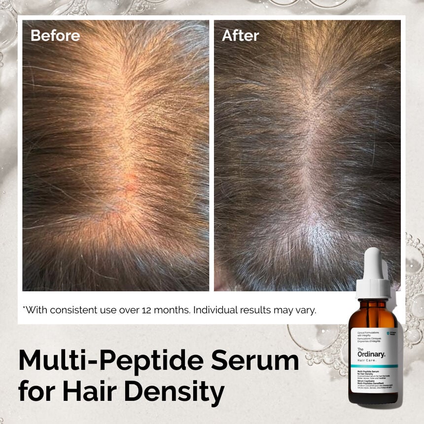 The Ordinary Multi-Peptide Serum for Hair Density 60ml official before and after image