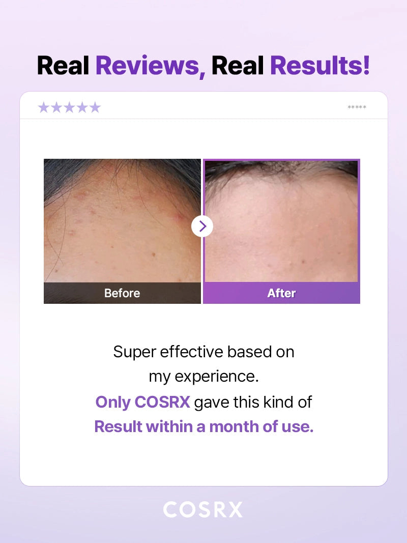COSRX AHA BHA Clarifying Treatment Toner 150ml skin results